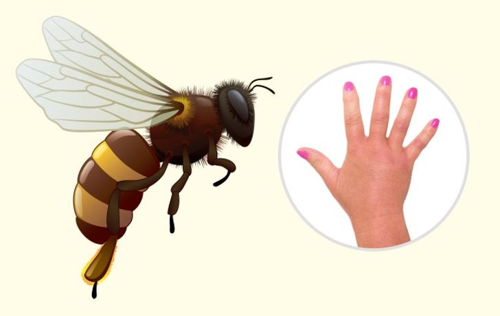 10 Bug Bites Anyone Should Be Able to Identify