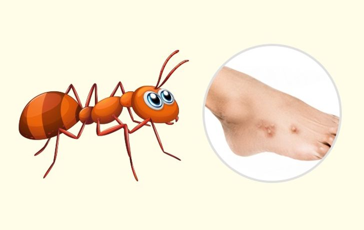 10 Bug Bites Anyone Should Be Able to Identify