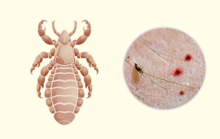 10 Bug Bites Anyone Should Be Able to Identify