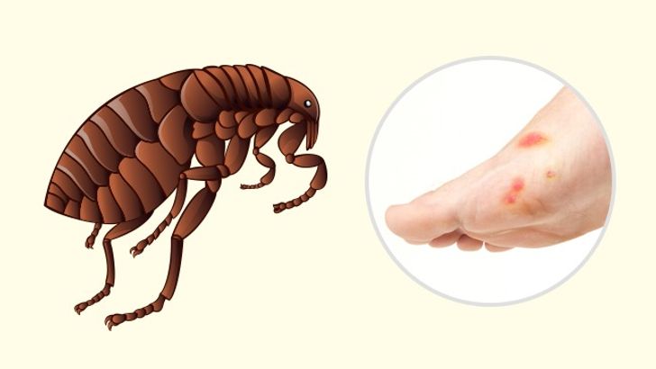 10 Bug Bites Anyone Should Be Able to Identify