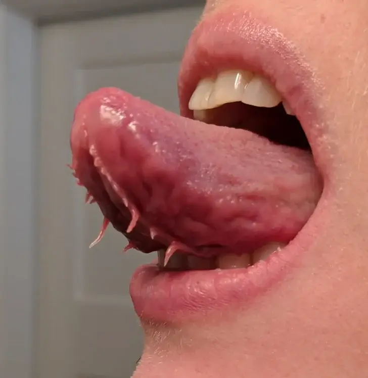 Tentacles under tongue