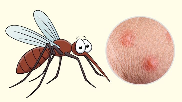 10 Bug Bites Anyone Should Be Able to Identify
