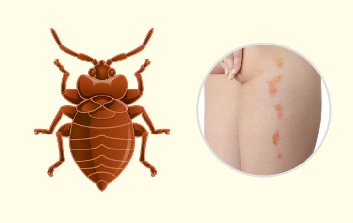 10 Bug Bites Anyone Should Be Able to Identify